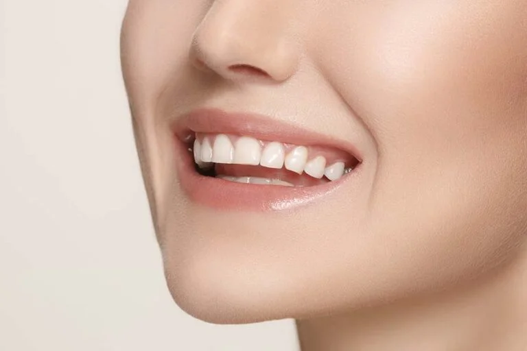 teeth whitening